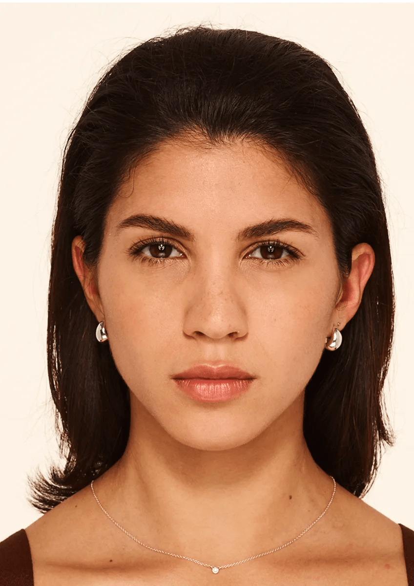Same BOTOX Cosmetic patient after treatment at maximum frown